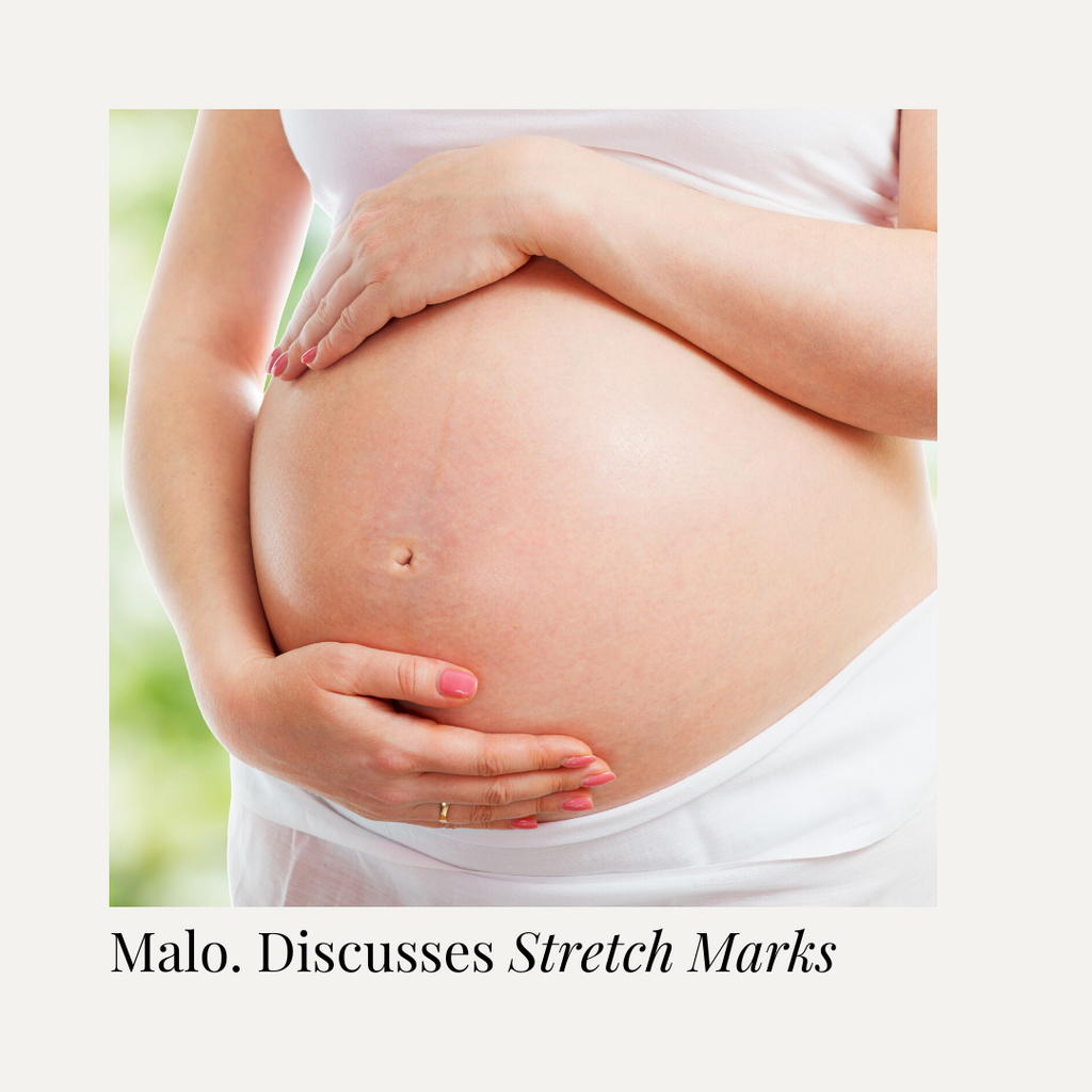 Let’s talk about stretch marks: